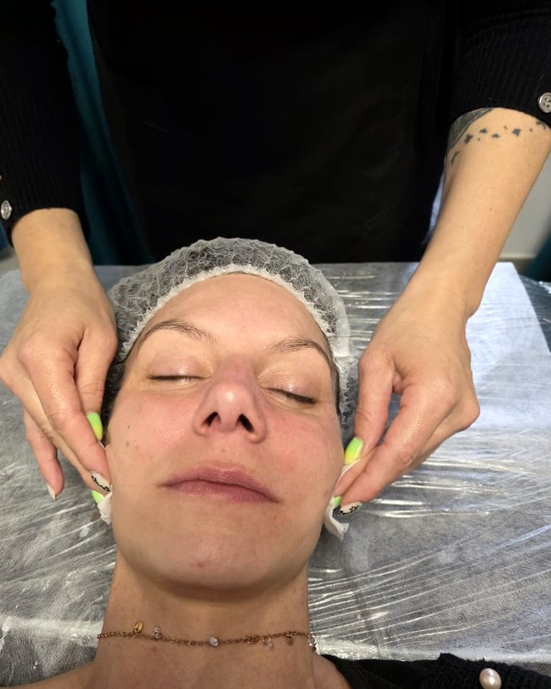 Désinfection du visage au coton avant microneedling